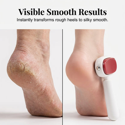 2 in 1 Foot Callus Remover Dual Sided Scraper with Replaceable Stainless Steel Blades